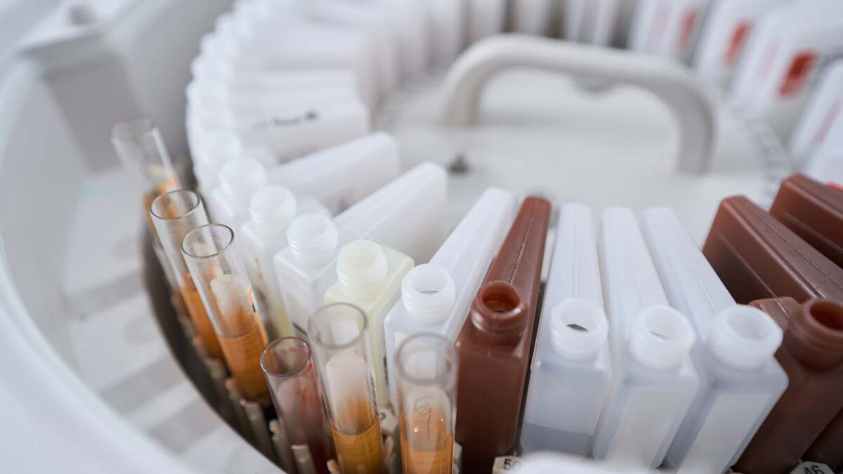 IVDR in vitro diagnostic regulation compliance